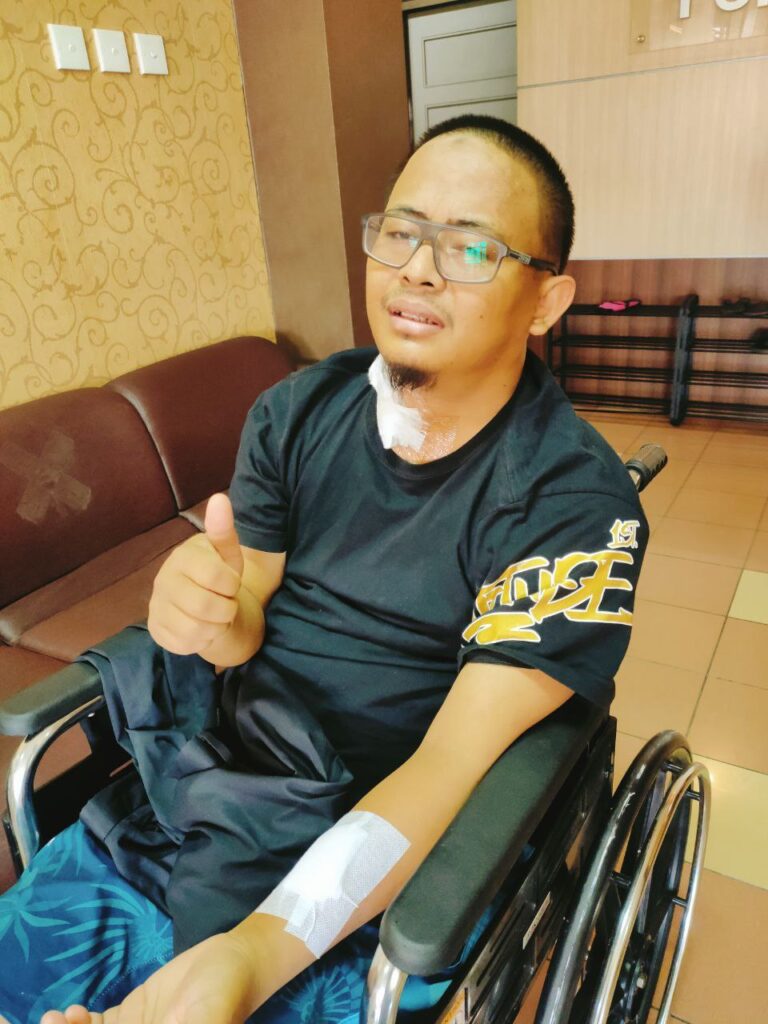 Proses tahap 1 – operasi bedah vaskular untuk akses HD (AV shunt) di tangan Pak Gigih